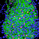 The hormone betatrophin. (Image: Douglas Melton, Harvard University)